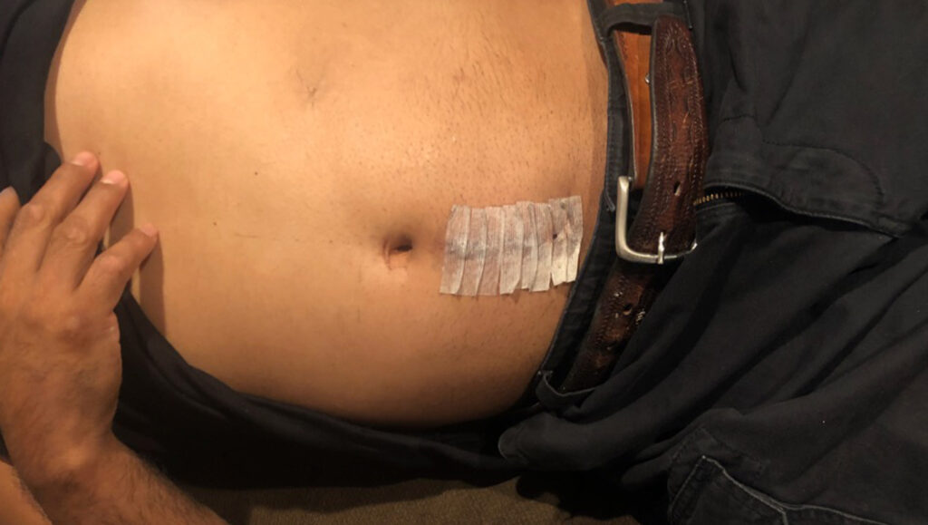 One of the victims required surgery as a result of the defendant's illegal U-turn collision.
